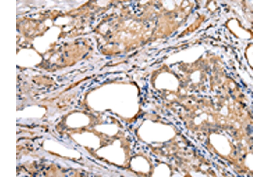 Immunohistochemistry - LRRC19 Antibody from Signalway Antibody (42917) - Antibodies.com