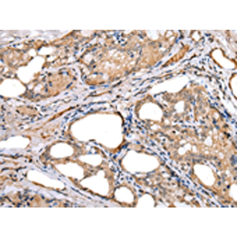 Immunohistochemistry - LRRC19 Antibody from Signalway Antibody (42917) - Antibodies.com