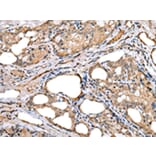 Immunohistochemistry - LRRC19 Antibody from Signalway Antibody (42917) - Antibodies.com
