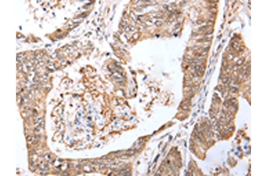 Immunohistochemistry - LRRC19 Antibody from Signalway Antibody (42917) - Antibodies.com