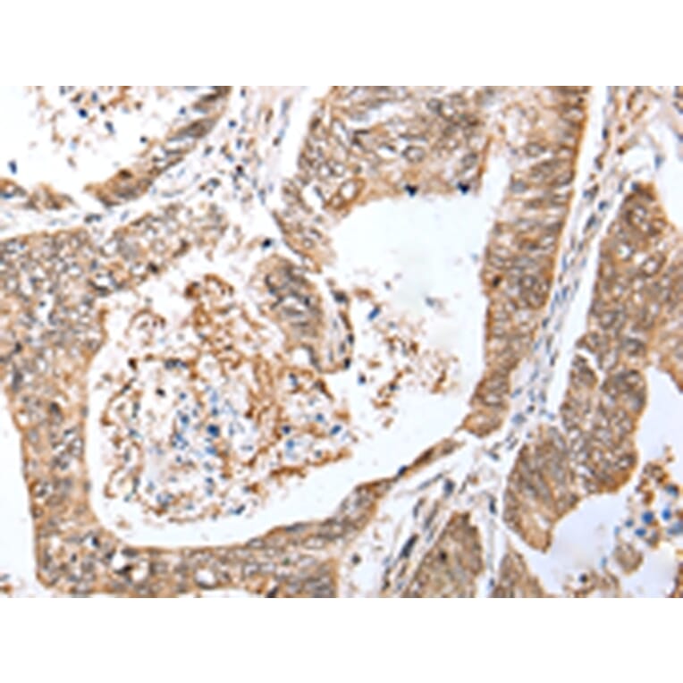 Immunohistochemistry - LRRC19 Antibody from Signalway Antibody (42917) - Antibodies.com
