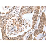 Immunohistochemistry - LRRC19 Antibody from Signalway Antibody (42917) - Antibodies.com