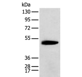 KCTD16 Antibody from Signalway Antibody (42919) - Antibodies.com
