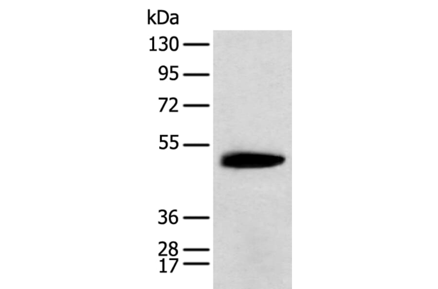 KCTD16 Antibody from Signalway Antibody (42919) - Antibodies.com