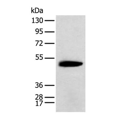 KCTD16 Antibody from Signalway Antibody (42919) - Antibodies.com