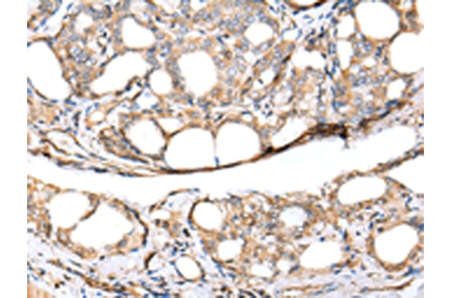 Immunohistochemistry - KCTD16 Antibody from Signalway Antibody (42919) - Antibodies.com