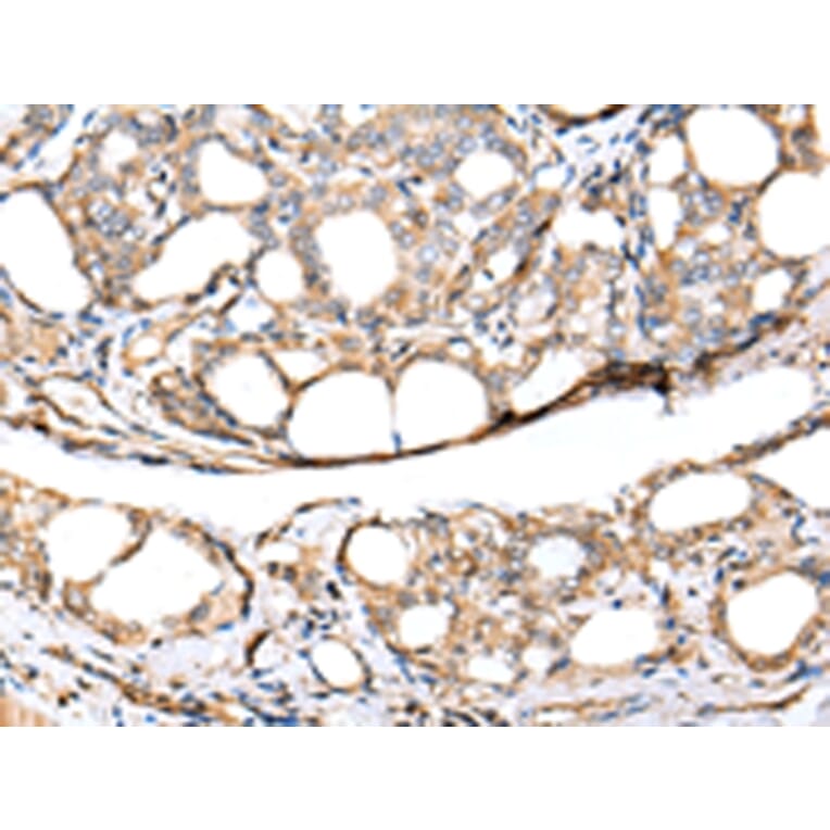 Immunohistochemistry - KCTD16 Antibody from Signalway Antibody (42919) - Antibodies.com