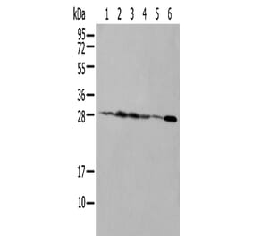 NUDT21 Antibody from Signalway Antibody (42943) - Antibodies.com