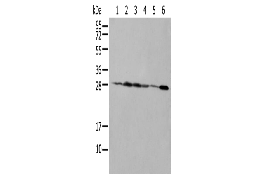 NUDT21 Antibody from Signalway Antibody (42943) - Antibodies.com