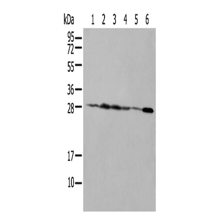 NUDT21 Antibody from Signalway Antibody (42943) - Antibodies.com
