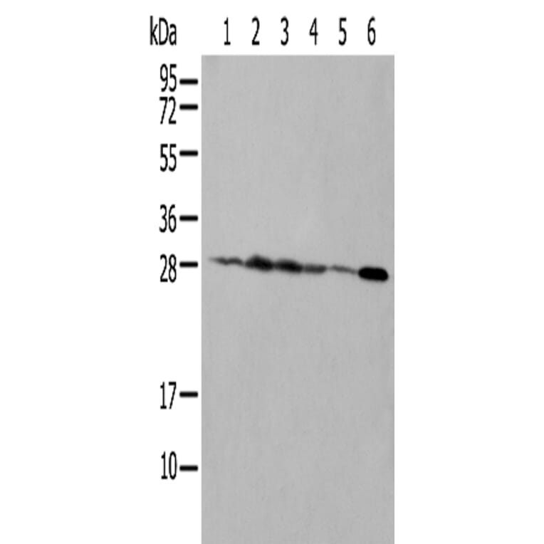 NUDT21 Antibody from Signalway Antibody (42943) - Antibodies.com