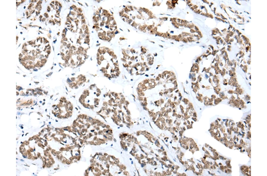 Immunohistochemistry - NUDT21 Antibody from Signalway Antibody (42943) - Antibodies.com