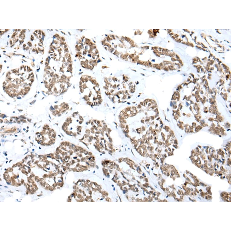 Immunohistochemistry - NUDT21 Antibody from Signalway Antibody (42943) - Antibodies.com