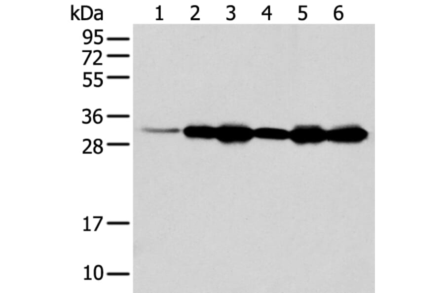 NUDT22 Antibody from Signalway Antibody (42945) - Antibodies.com