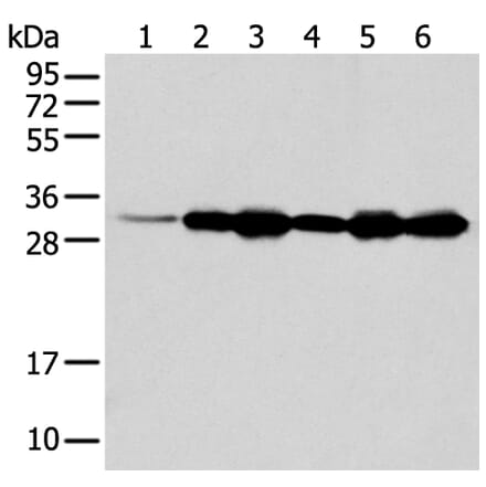 NUDT22 Antibody from Signalway Antibody (42945) - Antibodies.com