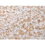 Immunohistochemistry - NUDT22 Antibody from Signalway Antibody (42945) - Antibodies.com