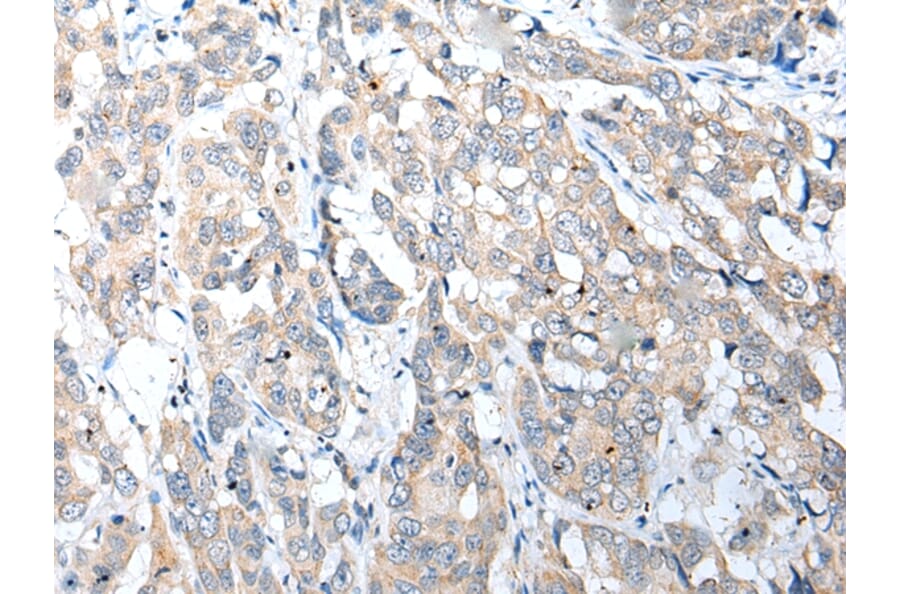 Immunohistochemistry - NUDT22 Antibody from Signalway Antibody (42945) - Antibodies.com