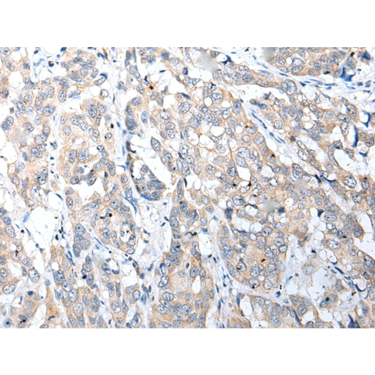 Immunohistochemistry - NUDT22 Antibody from Signalway Antibody (42945) - Antibodies.com