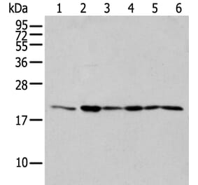EEF1E1 Antibody from Signalway Antibody (42964) - Antibodies.com