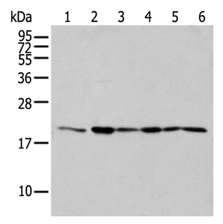 EEF1E1 Antibody from Signalway Antibody (42964) - Antibodies.com