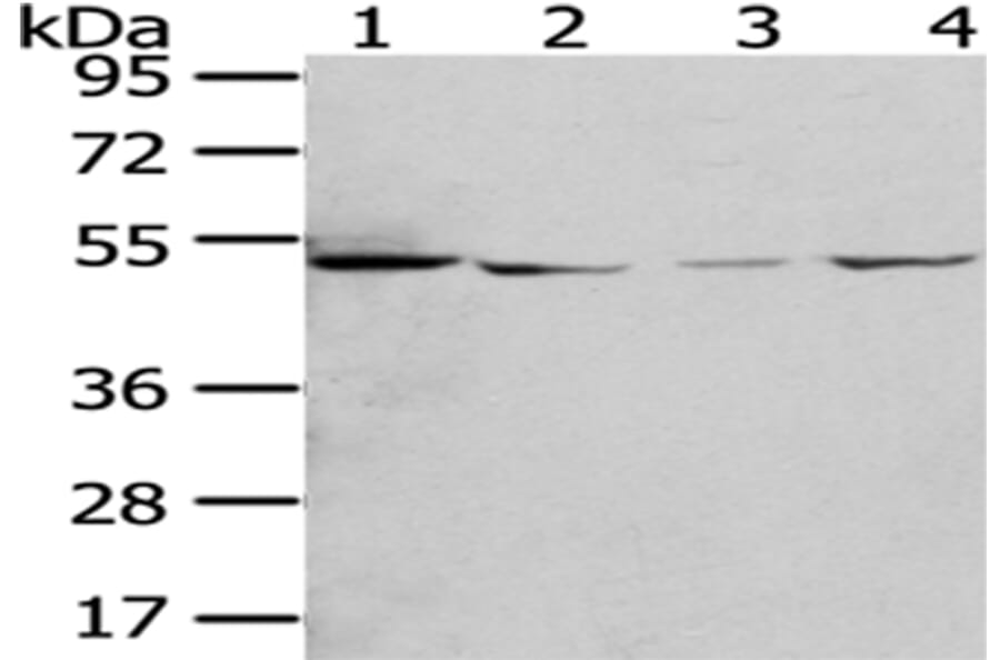 RUVBL2 Antibody from Signalway Antibody (43009) - Antibodies.com
