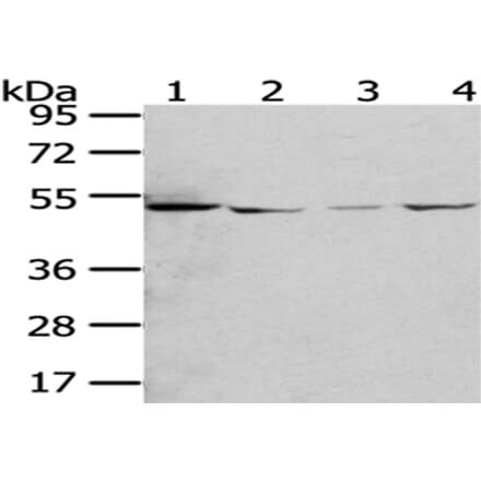 RUVBL2 Antibody from Signalway Antibody (43009) - Antibodies.com