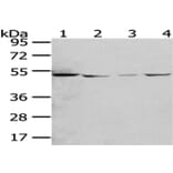 RUVBL2 Antibody from Signalway Antibody (43009) - Antibodies.com
