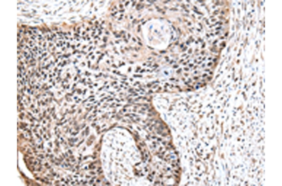 Immunohistochemistry - RUVBL2 Antibody from Signalway Antibody (43009) - Antibodies.com