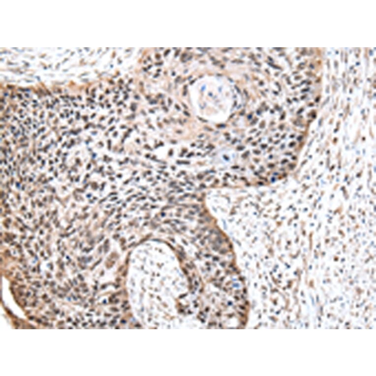 Immunohistochemistry - RUVBL2 Antibody from Signalway Antibody (43009) - Antibodies.com