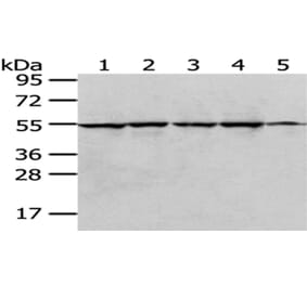 RUVBL1 Antibody from Signalway Antibody (43036) - Antibodies.com