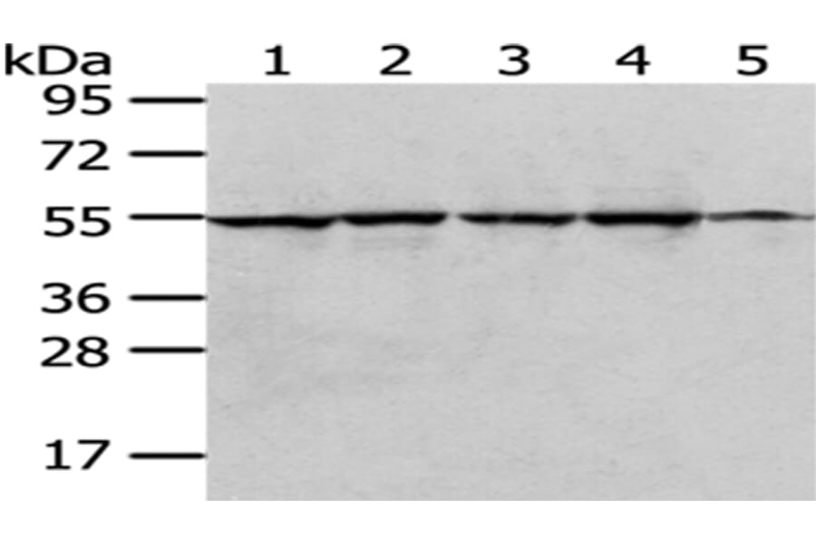 RUVBL1 Antibody from Signalway Antibody (43036) - Antibodies.com