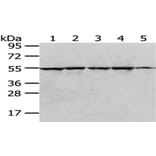 RUVBL1 Antibody from Signalway Antibody (43036) - Antibodies.com