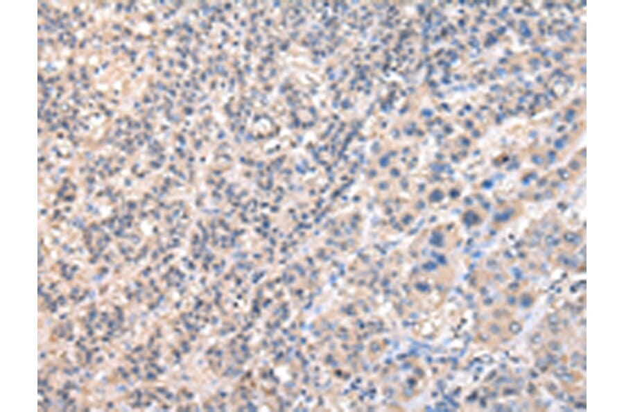 Immunohistochemistry - RUVBL1 Antibody from Signalway Antibody (43036) - Antibodies.com