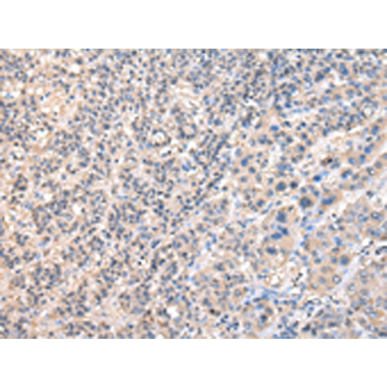 Immunohistochemistry - RUVBL1 Antibody from Signalway Antibody (43036) - Antibodies.com