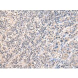 Immunohistochemistry - RUVBL1 Antibody from Signalway Antibody (43036) - Antibodies.com