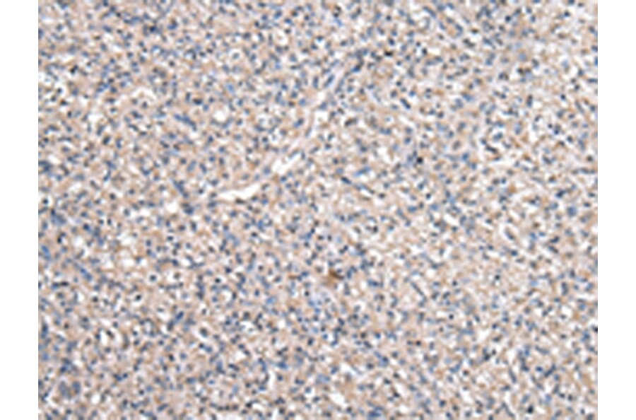 Immunohistochemistry - RUVBL1 Antibody from Signalway Antibody (43036) - Antibodies.com