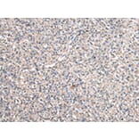 Immunohistochemistry - RUVBL1 Antibody from Signalway Antibody (43036) - Antibodies.com