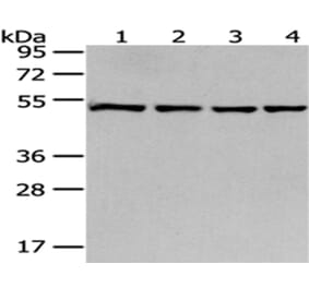 MRPS30 Antibody from Signalway Antibody (43042) - Antibodies.com