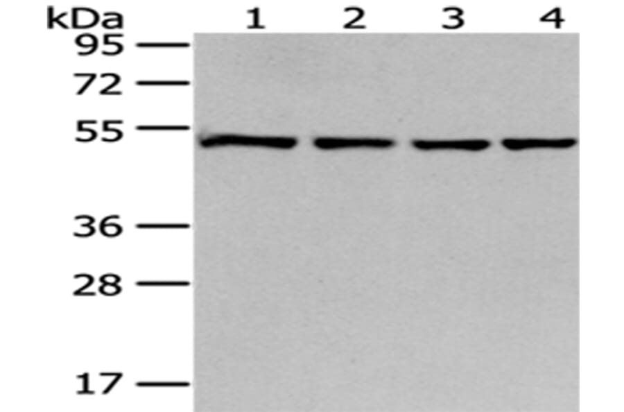 MRPS30 Antibody from Signalway Antibody (43042) - Antibodies.com