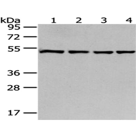 MRPS30 Antibody from Signalway Antibody (43042) - Antibodies.com
