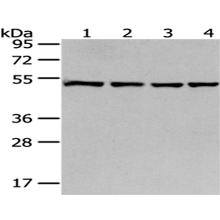 MRPS30 Antibody from Signalway Antibody (43042) - Antibodies.com