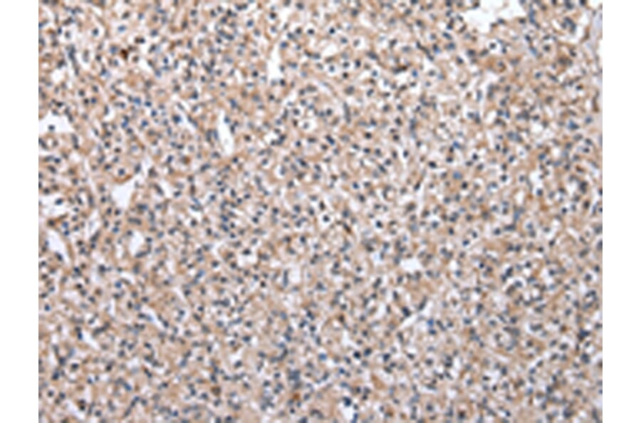 Immunohistochemistry - MRPS30 Antibody from Signalway Antibody (43042) - Antibodies.com