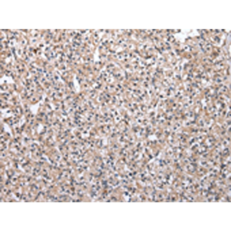 Immunohistochemistry - MRPS30 Antibody from Signalway Antibody (43042) - Antibodies.com