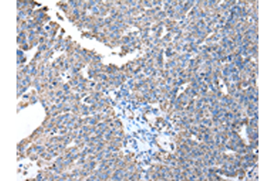 Immunohistochemistry - ATP5A1 Antibody from Signalway Antibody (43046) - Antibodies.com