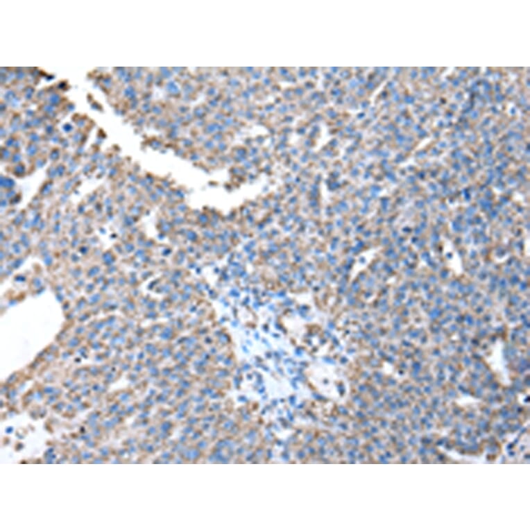 Immunohistochemistry - ATP5A1 Antibody from Signalway Antibody (43046) - Antibodies.com