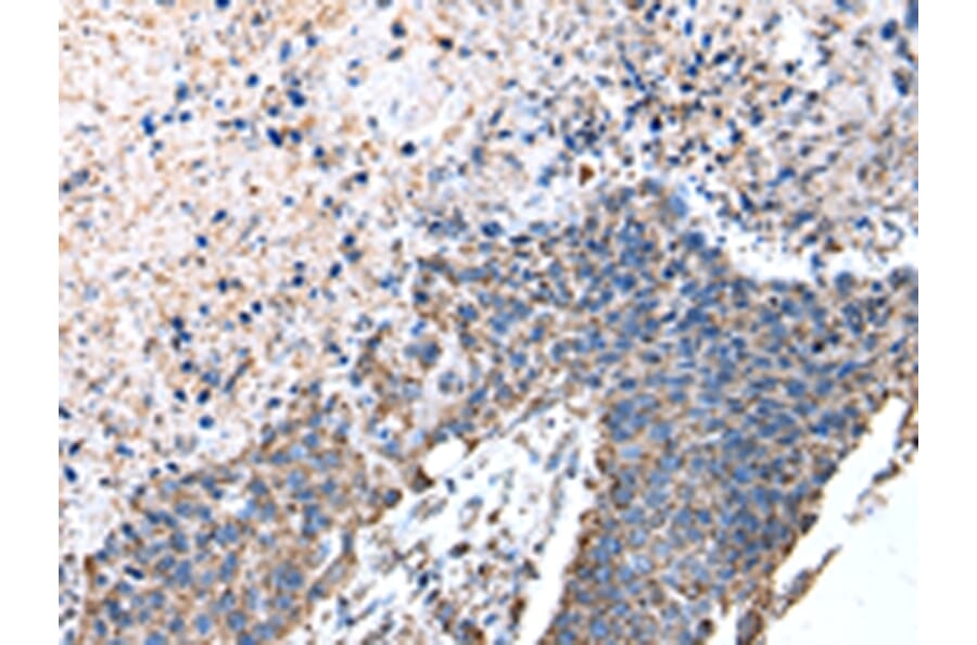 Immunohistochemistry - ATP5A1 Antibody from Signalway Antibody (43046) - Antibodies.com