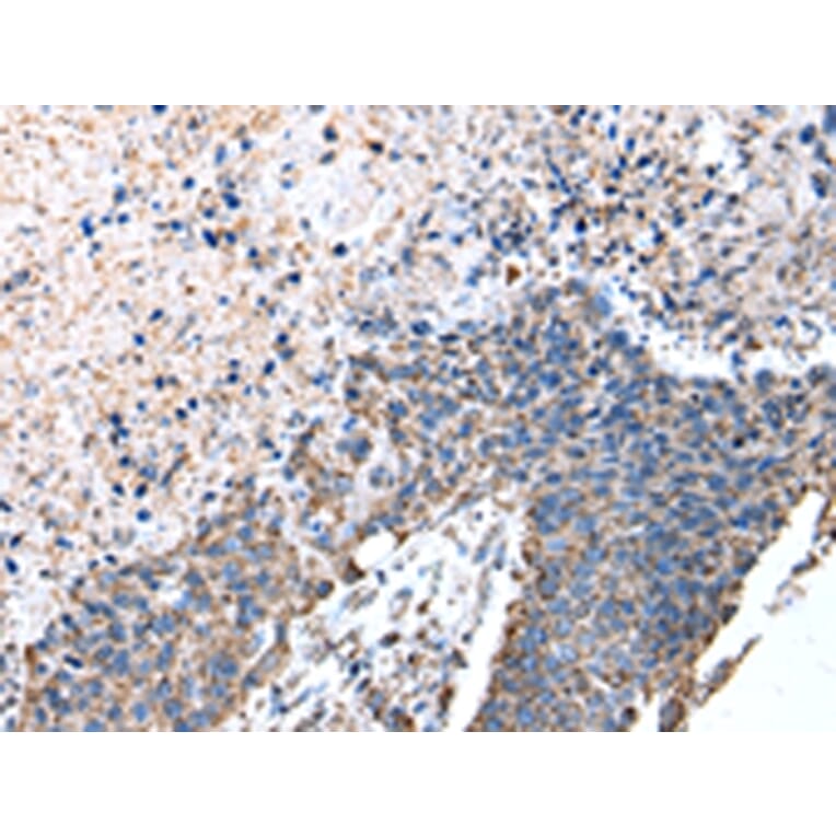Immunohistochemistry - ATP5A1 Antibody from Signalway Antibody (43046) - Antibodies.com
