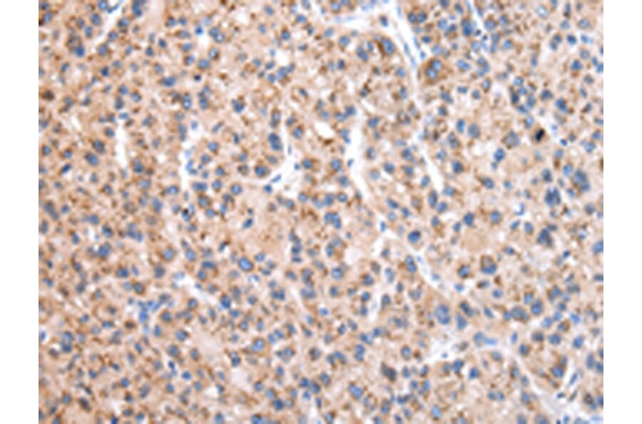 Immunohistochemistry - EEF1B2 Antibody from Signalway Antibody (43073) - Antibodies.com