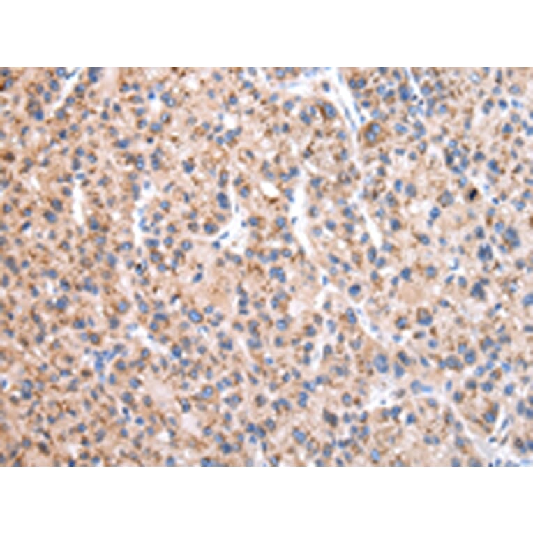 Immunohistochemistry - EEF1B2 Antibody from Signalway Antibody (43073) - Antibodies.com