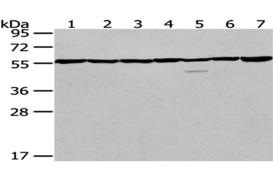 PRPF19 Antibody from Signalway Antibody (43084) - Antibodies.com